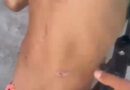 Menino de 4 anos é encontrado com lesões pelo corpo e caso mobiliza polícia em Araguaína