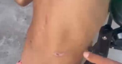 Menino de 4 anos é encontrado com lesões pelo corpo e caso mobiliza polícia em Araguaína