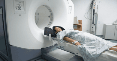 Esclerose múltipla não tem cura, mas tratamento ajuda a controlar sintomas e a reduzir risco de progressão Esclerose múltipla não tem cura, mas tratamento ajuda a controlar sintomas e a reduzir risco de progressão